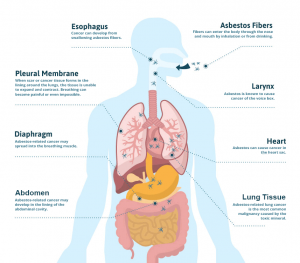 Asbestos-Fibers-Diagram-01