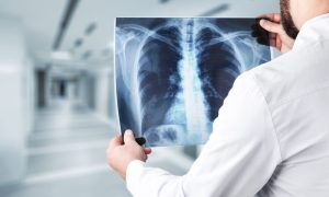 X-Ray Imaging Systems